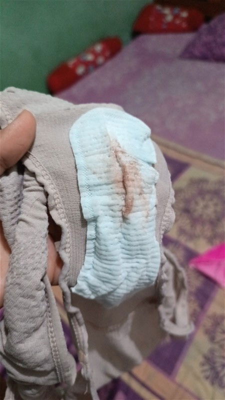 Ngeflek di usia 4minggu