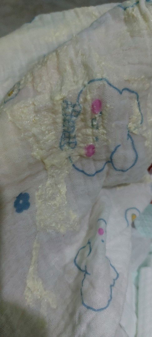 Ọc sữa ở trẻ sơ sinh