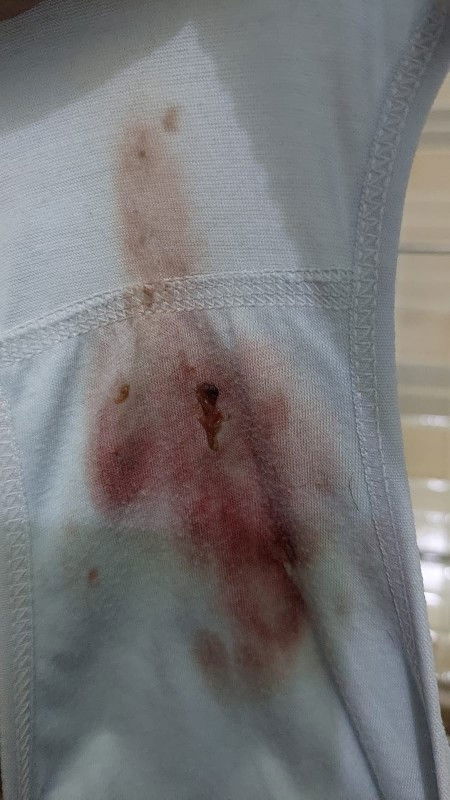 Darah haid atau apa?