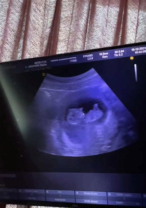 หัวใจฟูเมื่อเจอเจ้าตัวน้อย หลังจากแท้งมา2รอบ