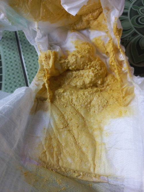 Bun mau tanya apakah bab bayi sperti ini di katakan diare ??? Tapi debay tidak rewel bayi full sufor