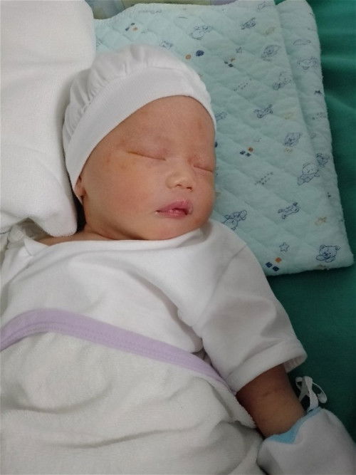 Delivered this cute baby little boy via Cesarean Section 2.8kgs breech presentation on Dec. 14, 2023