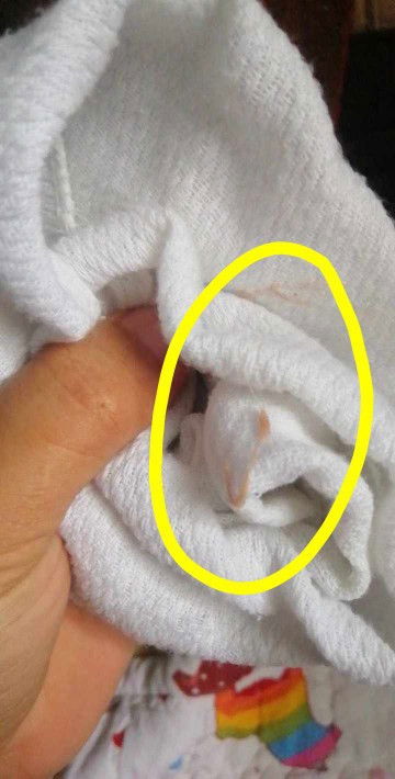 nag lunggad si baby or suka after dede po breastfeeding po nilagay sa bottle after po may lumabas