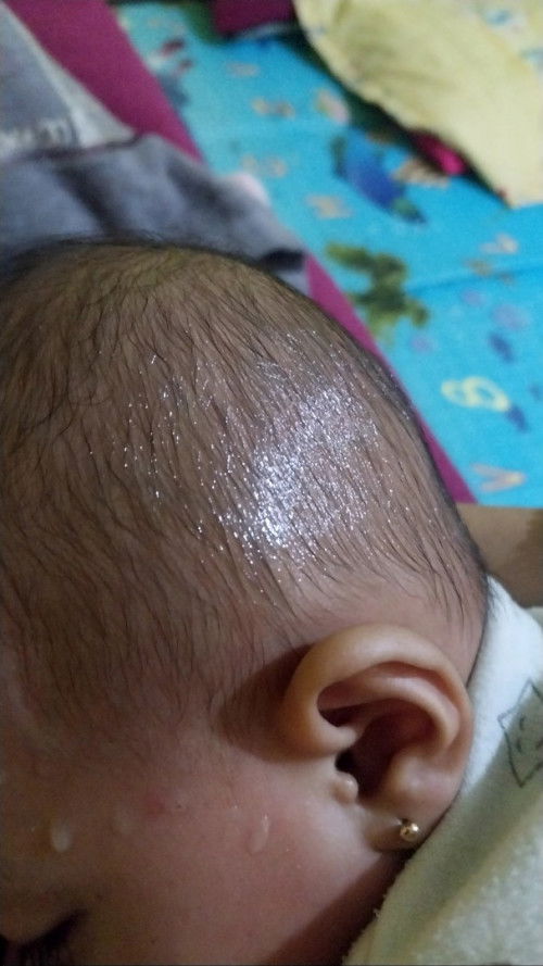 Bayi umur 8bulan, ketika menyusu berkeringat apakah normal?