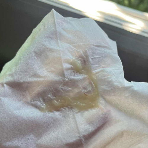 มีมูกใสๆออกมาแต่ไม่ปวดท้อง 38วีค6 ต้องไปหาหมอไหมคะ