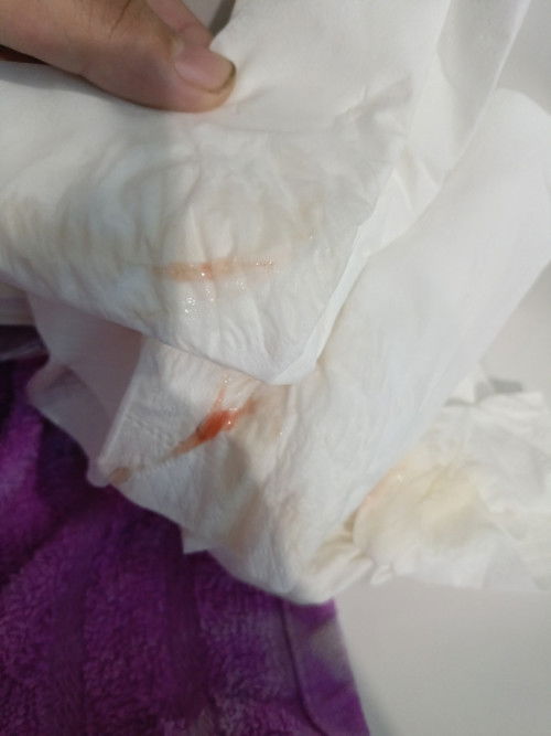 Good morning first time mom Edd: dec 25 2023

Mapapaaga puba pag may lumabas na ganto?