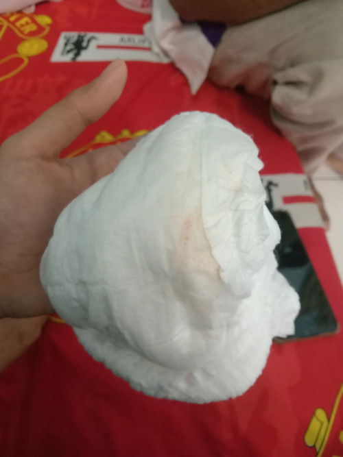 Pemper bayi ada bercak oren