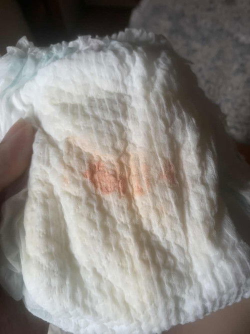 bercak merah dipopok bayi 5 bulan