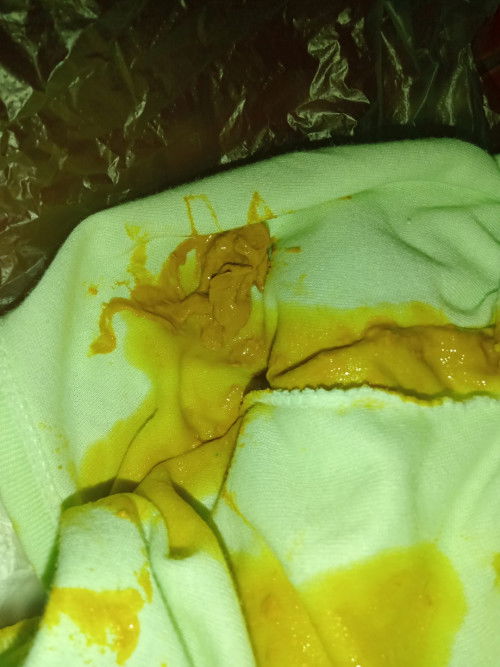 อึแบบนี้ปกติไหมคะ