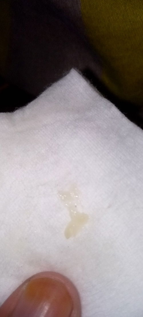 Keluar lendir kental hpl 18 Januari