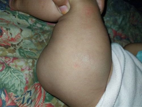 HPL Agustus Imunisasi DPT