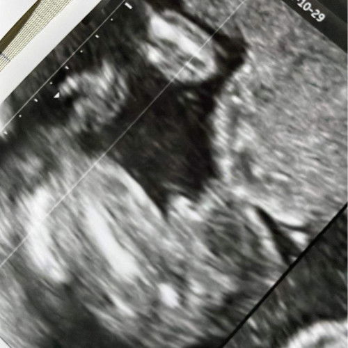 แม่ๆพอรู้ไหมคะว่าส่วนนี่คือส่วนไหนของน้อง