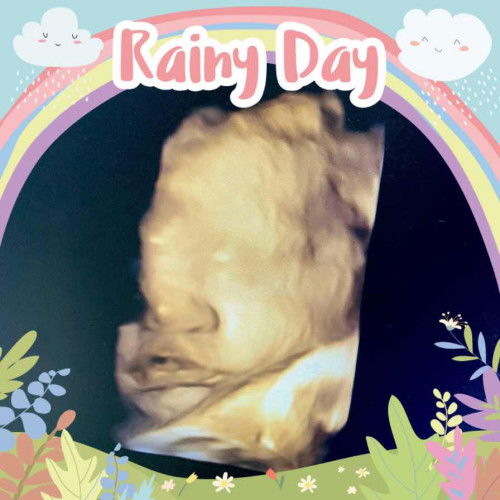 ภาพอัลตราซาวด์