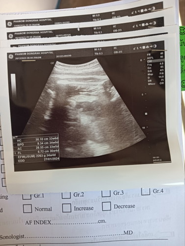 ตอนนี้36w4dน้ำหนัก 2263เองตะหมอบอกตามเกณตุ2500 เเต่เหลืออีกอีก1เดือนน้ำหนักจะขึ้นไหมคะ