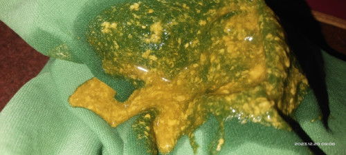 Bab bayi cair itu normal apa diare