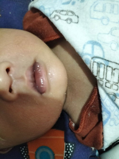 Bibir new born kadang menghitam