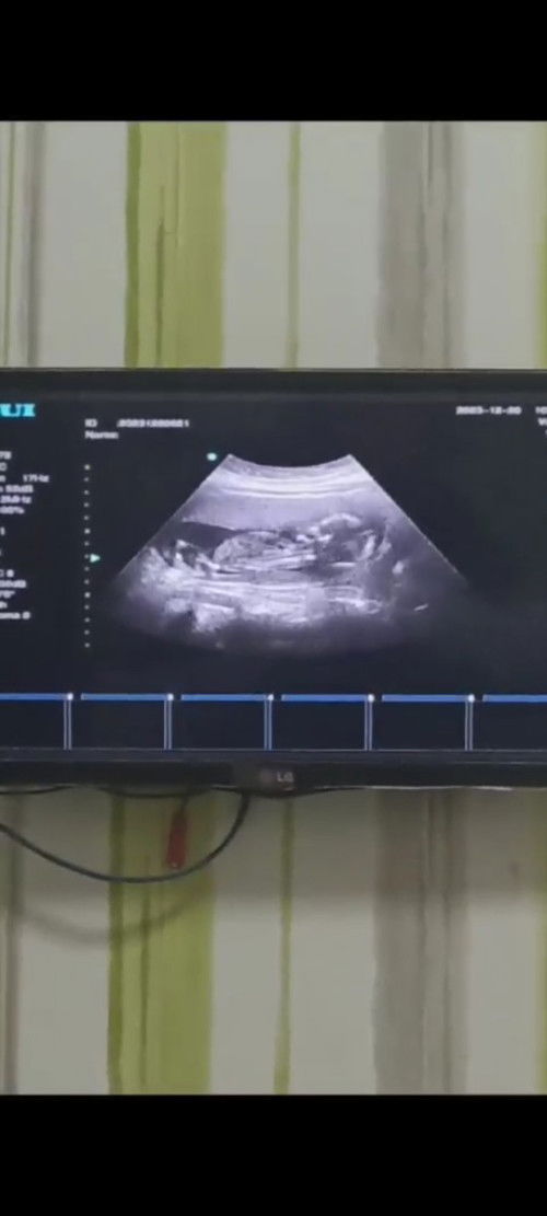 Flek di usia 15weeks