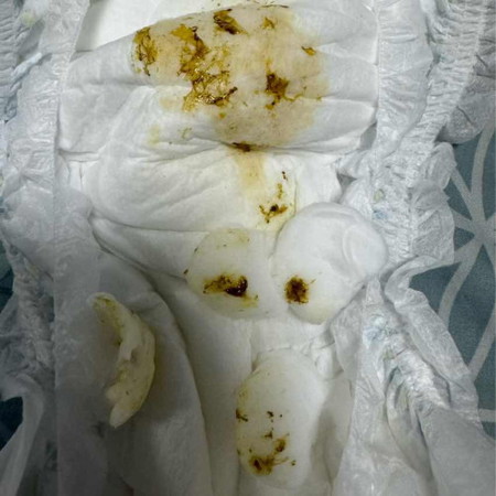 น้องถ่ายเป็นมูกสีเขียวๆดำๆ