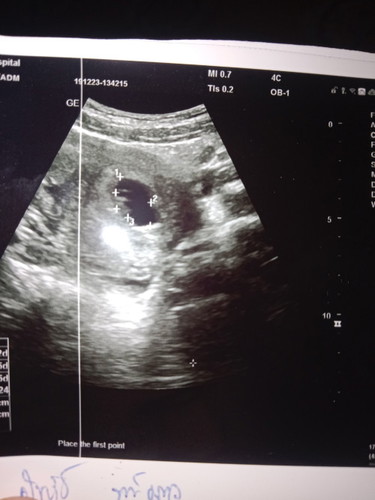 ซาวด์ไม่เห็นตัวน้องเลย😰