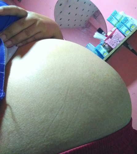 แม่ๆช่วยดูทีค่ะท้องลักษณะนี้จะได้ผู้หญิงหรือผู้ชายค่ะ😊
22week❤