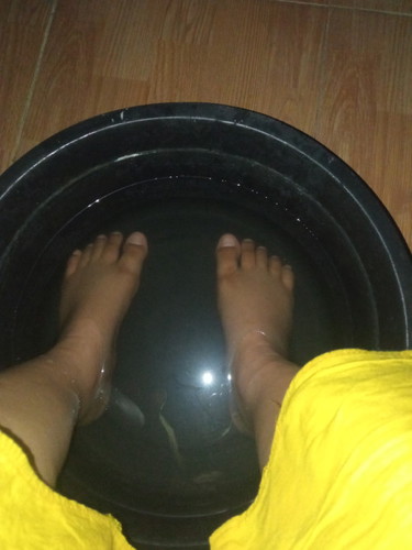Ada yg pernah ngalamin kaki bengkak saat hamil?