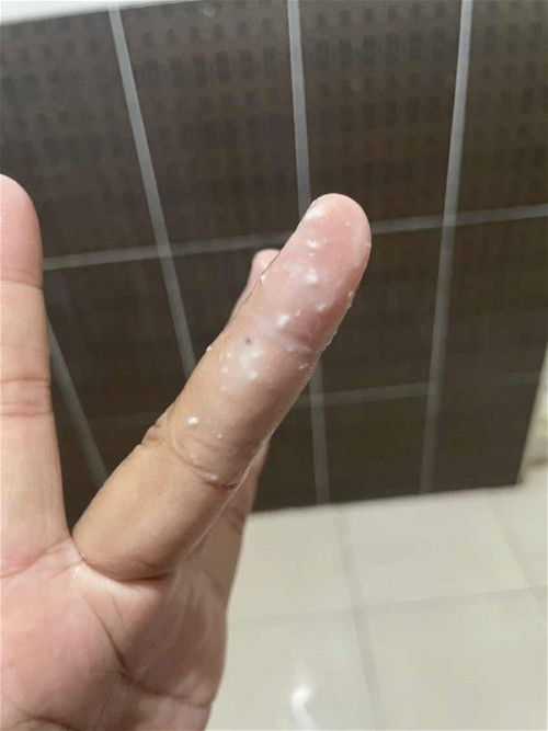 ขออภัยหากรูปภาพไม่เหมาะสมด้วยนะคะ