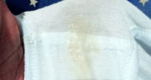 Hamil 36w 4d, hamil pertama