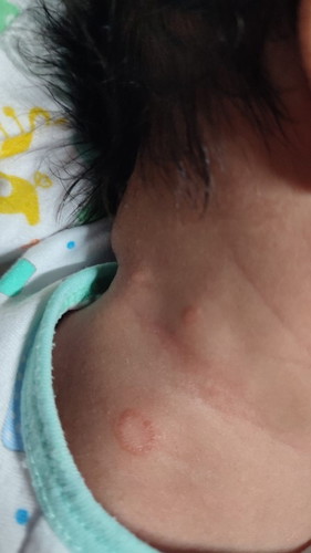 May idea po ba kayo ano ito sa skin ni baby?