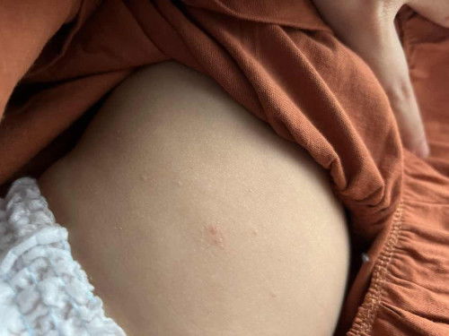 Bun ini kenapa yaa? Ada yg pernah?