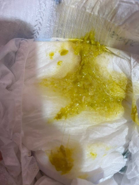 Hello ibu2 normal ka najis warna bgni? Full bf & bby 4month