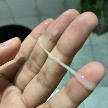 แม่ๆ 36วีค 1วัน