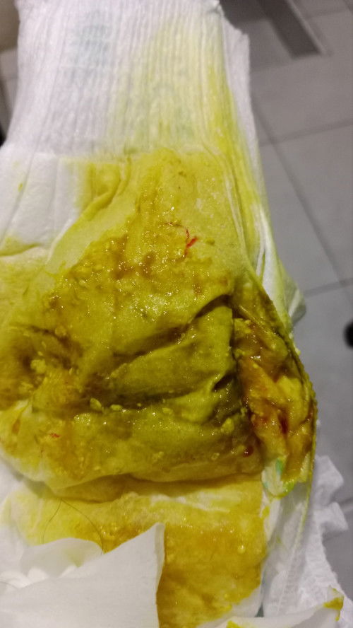 Bab bayi selalu berlendir  , semalam bab berlendir ada darahnya tanpa demam