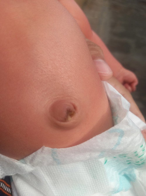 Puser bayi