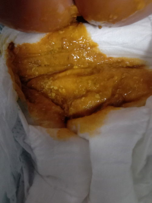 Pasintabi po sa mga kumakain or kakain palang.