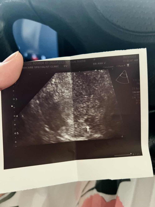 5 minggu pregnant