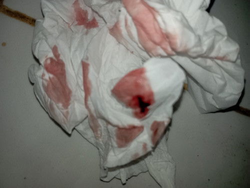 Bunda" mau tanya klo sering keluar kaya gini kira" knpa ya soalnya di usg janin nya blm keliatan,