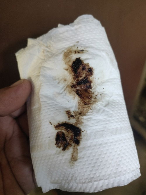 Brown discharge after ie
Na ie po ako yesterday & after that maraming brown discharge til now