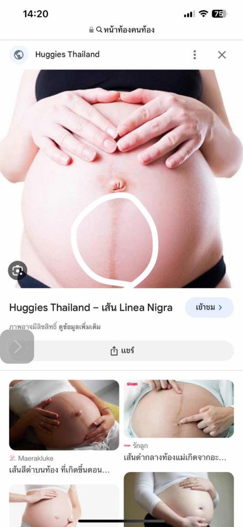ท้องแรก 36+3 วันนี้อยู่ๆก็มีอาการปวดตรงที่วงค่ะ ปวดหน่วงๆเหมือนจะเป็นประจำเดือน