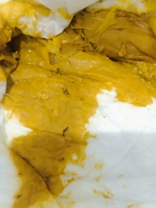 bab bayi ada serat hitamnya atau cacing