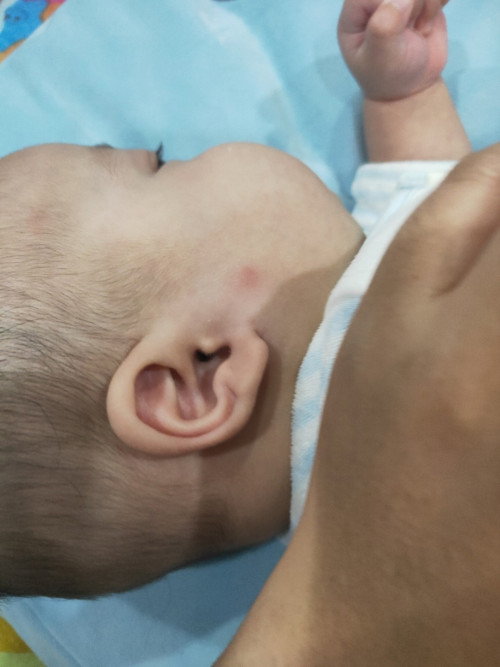 มดแมลงกัดใช้ยาอะไรทาได้บ้างG6PD