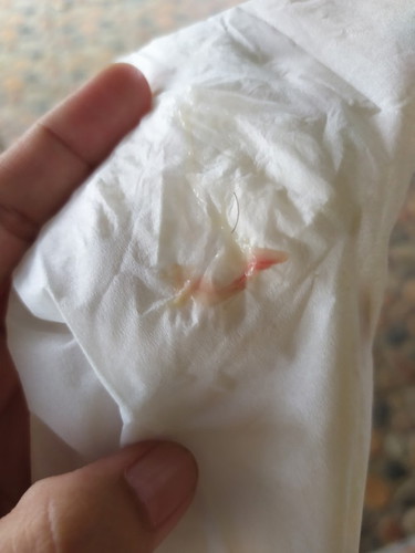 Bun td siang keputihan tp ada flek, di tmbah perut bwh sakit ngilu smpe skrg, lg mnm obat penguat jg