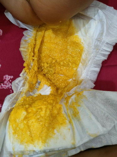 Pup bayi 5 bulan