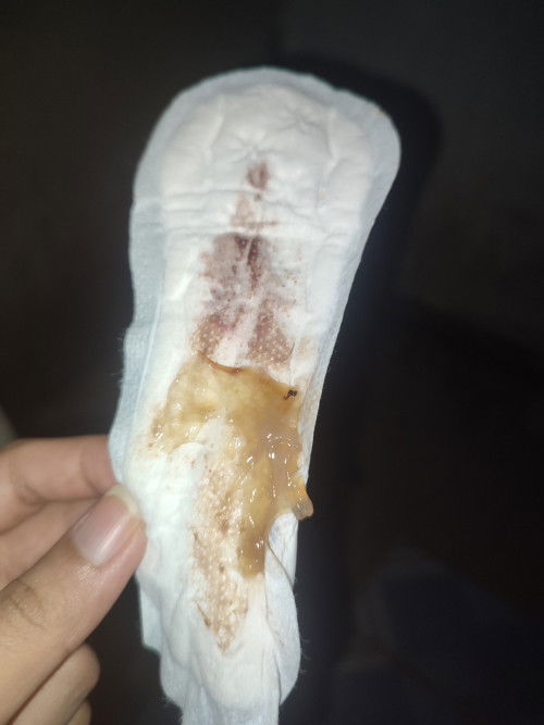 Mucus Plug or Semen? Trigger warning: (Photo with Blood)