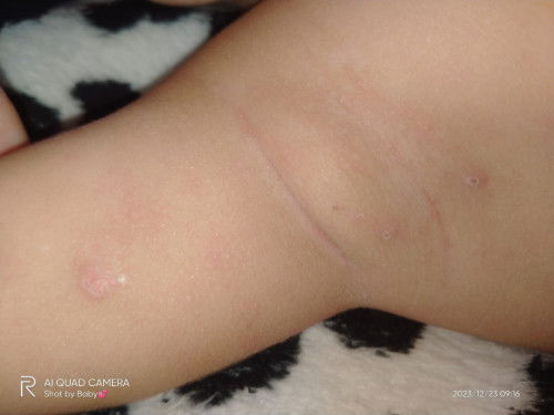 Knp kulit baby mengelupas mcm nih yahh