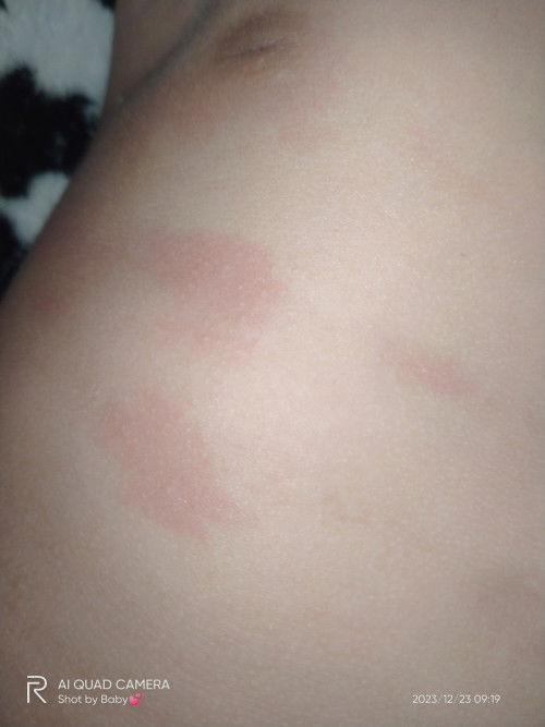 Baby dah 3hri keluar merah² mcm nih keluar lpstu hilang lagi knp erkk ?