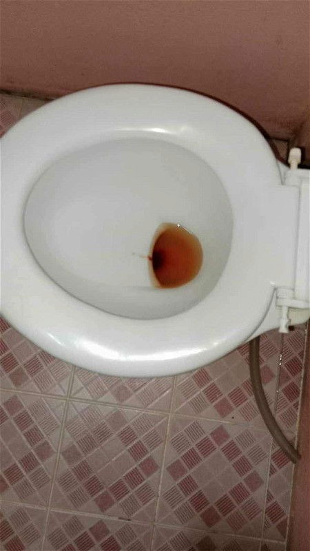 ไปหาหมอมา ปากมดลูกไม่เปิด ปวดท้อง ปวดๆหายๆ ให้กลับบ้าน