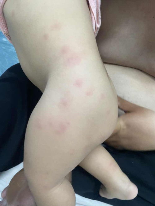 Bé nổi chấm tròn đỏ