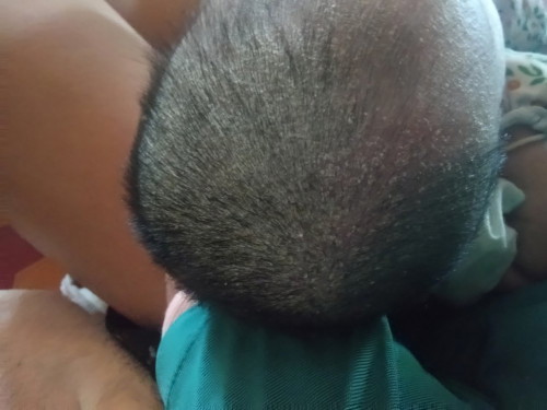 เกิดจากอะไรคะ?
น้องอายุ1เดือน7วัน