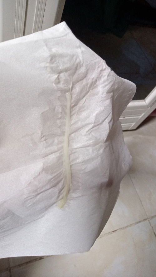 Keputihan saat hamil