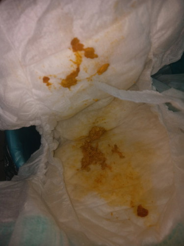 ถ่ายลักษณะแบบนี้ปกติมั้ยคะ